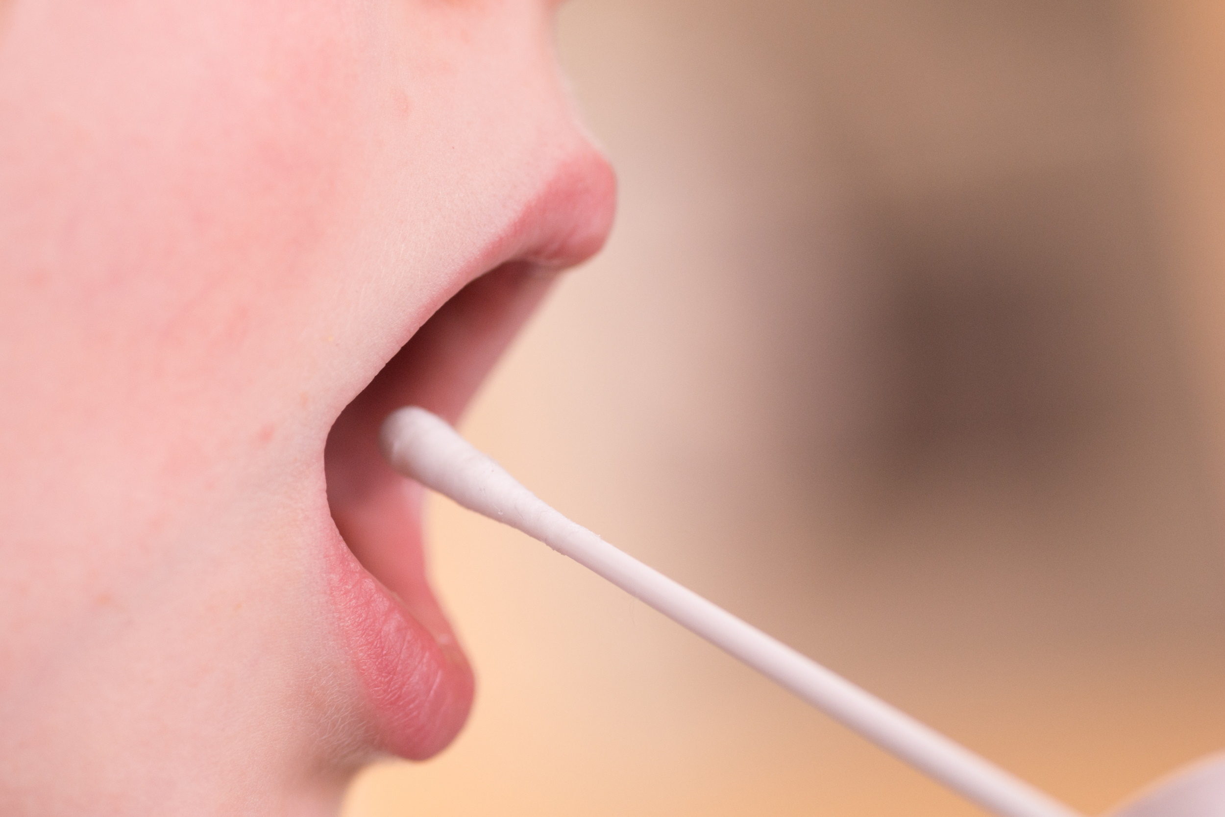 Geöffneter Mund eines Kindes mit Wattestäbchen vor den Lippen. Hintergrund verschwommen